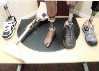 Prosthetic Devices